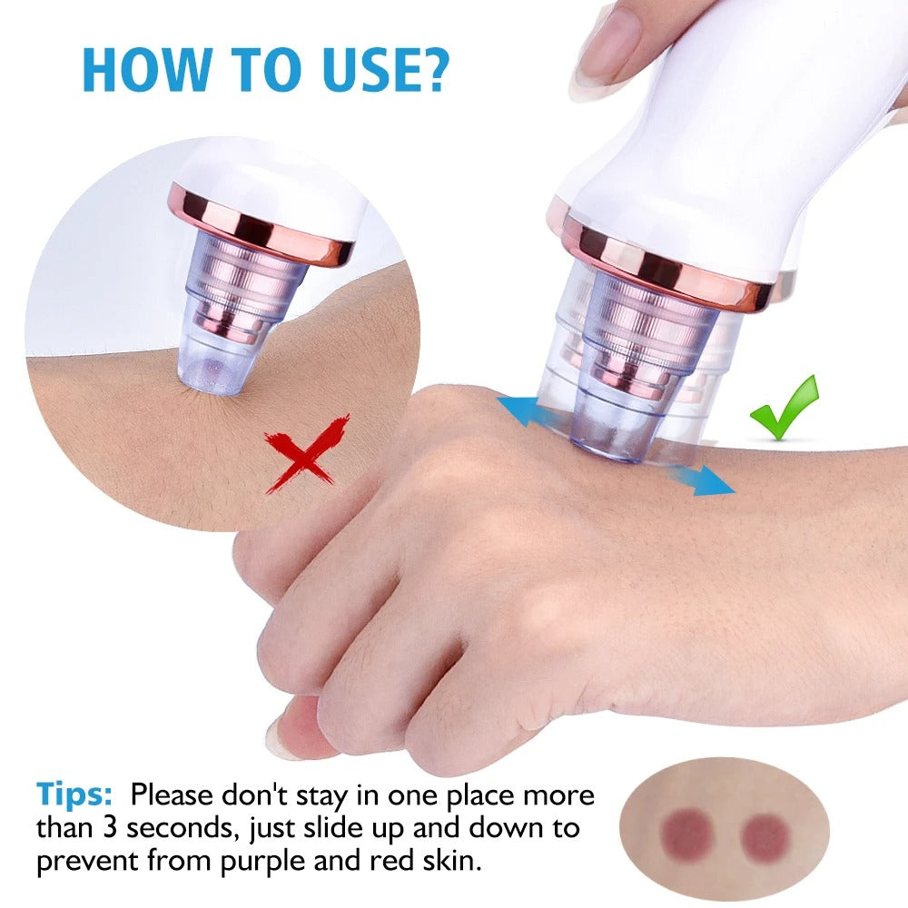 Blackhead Beauty Instrument / Pore Cleaner