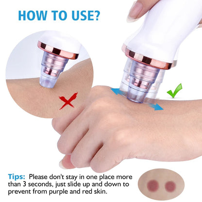 Blackhead Beauty Instrument / Pore Cleaner